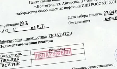 справки о гепатите и ВИЧ-инфекции для военкомата